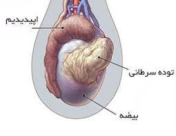 سرطان بیضه