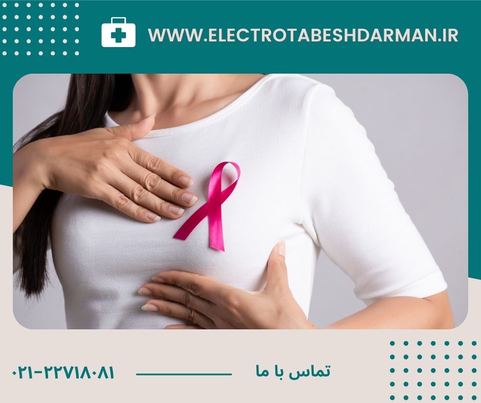 علائم سرطان سینه-الکتروتابش درمان