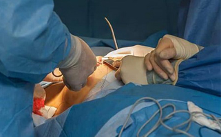 بهترین جراح سینه در تهران-الکتروتابش درمان