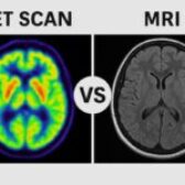 تفاوت پت اسکن و ام آر آی